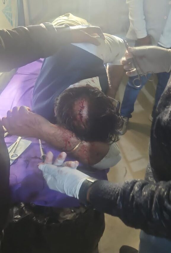 पहले राजधानी, अब अयोध्या—पत्रकारों पर लगातार हमले, पुलिस की कार्यशैली सवालों के घेरे में