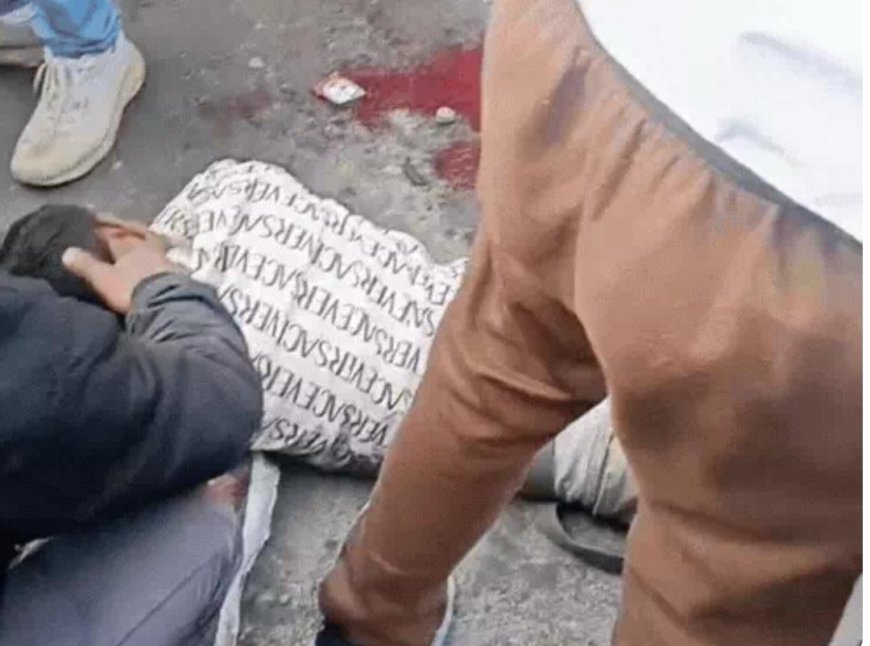 आगरा के बोदला में गैस के गुब्बारे&nbsp; का सिलेंडर फटने से मचा हड़कंप गुब्बारे बेच रहा युवक गंभीर रूप से घायल, अस्पताल में भर्ती