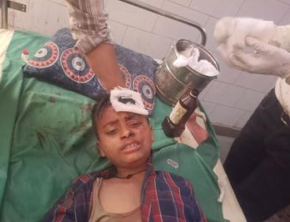 फर्रुखाबाद: तेज रफ्तार डंपर ने दो सगे भाइयों को रौंदा, पुलिया तोड़कर आधा लटका वाहन