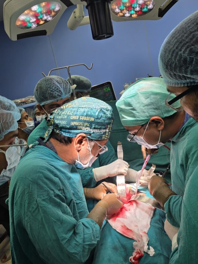 Three Complex Pediatric Surgeries Successfully Performed at SN Medical College, Agra